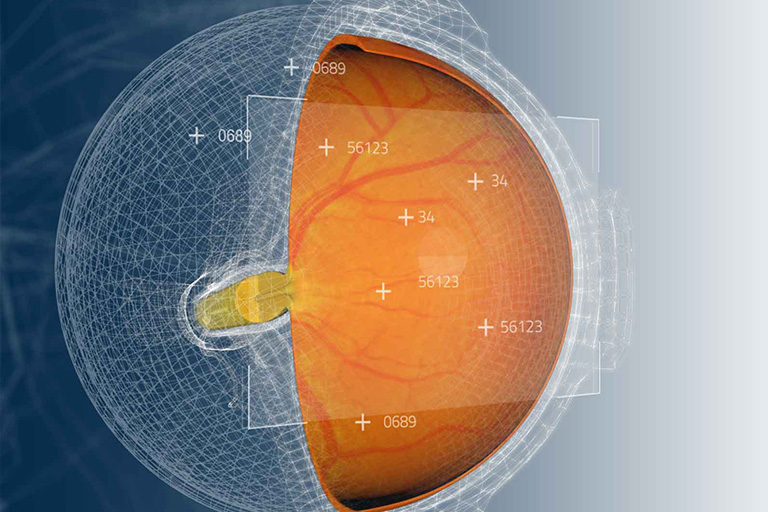 Toku Inc. Series A Preferred Investment Round Led by National Vision, Inc. and Topcon Healthcare